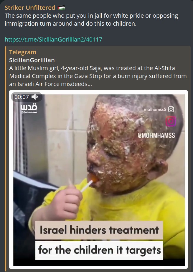 Image of badly burned Palestinian girl